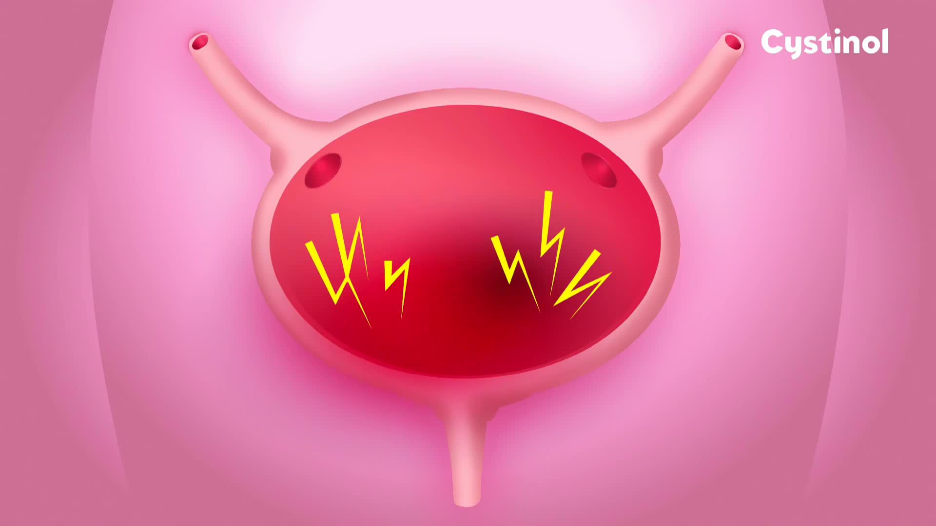 HRT1