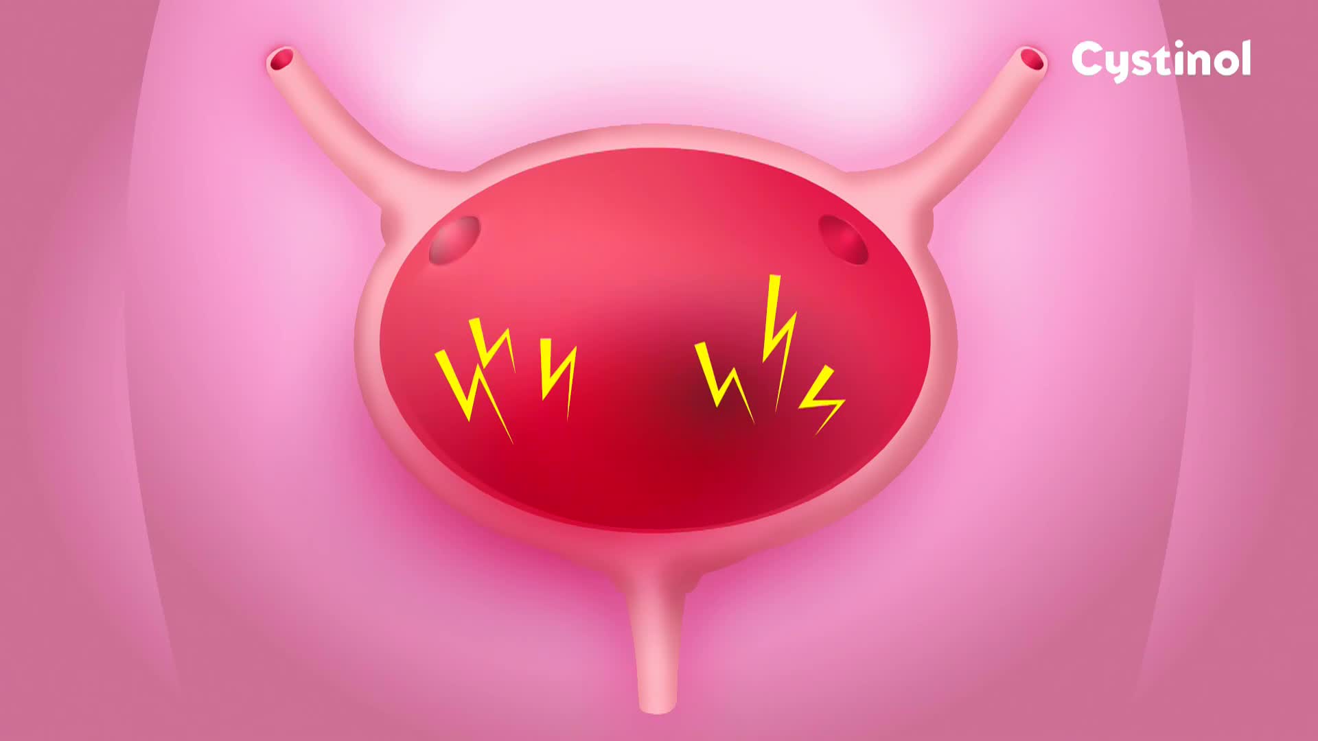 HRT1