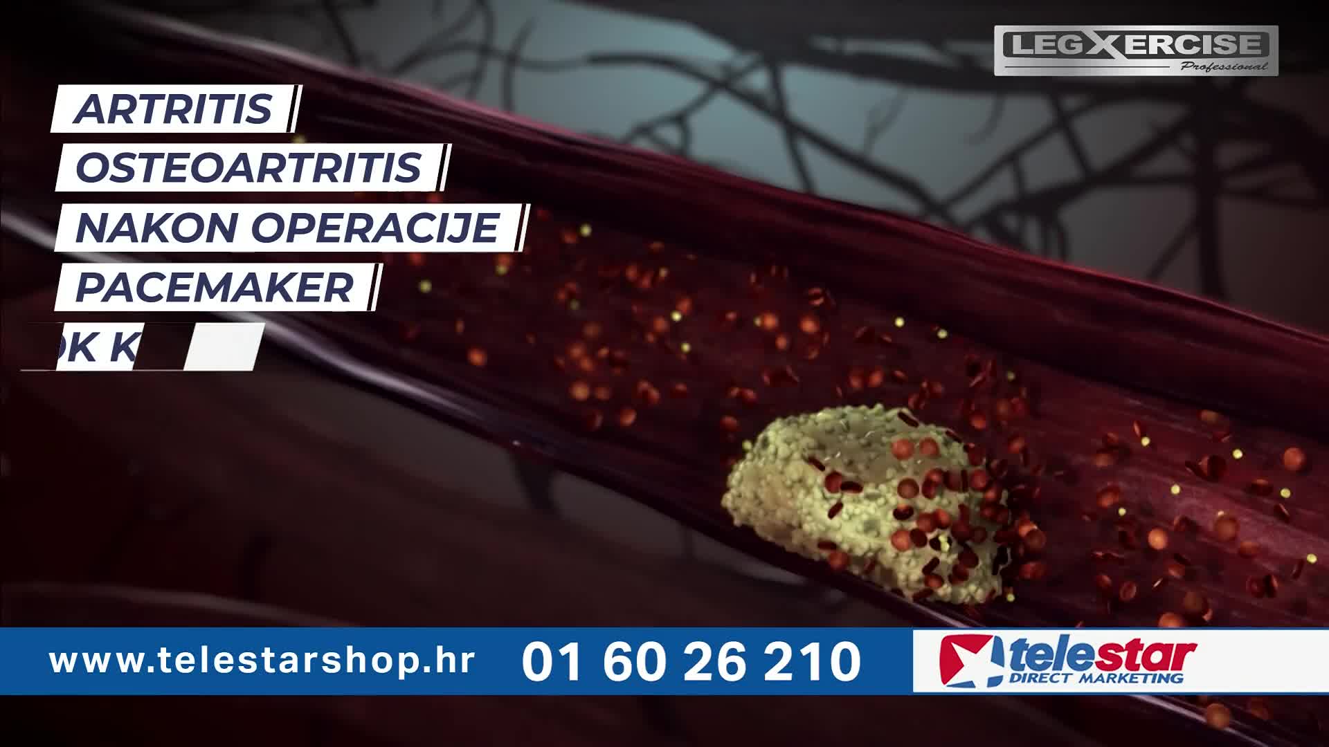 RTL