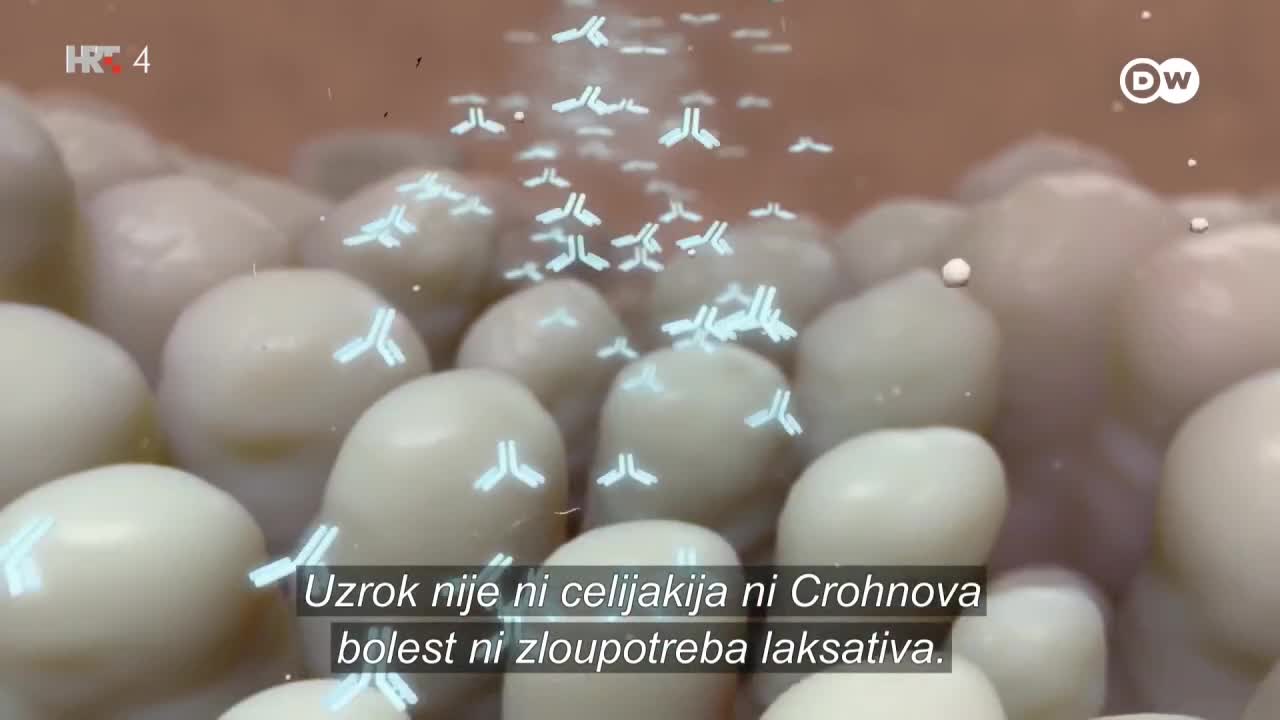 HRT4