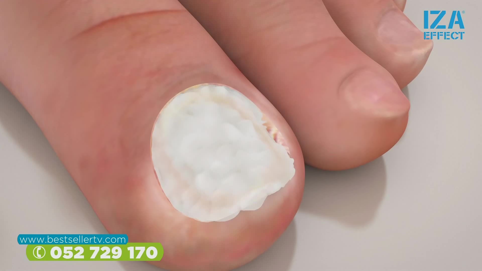 RTL2