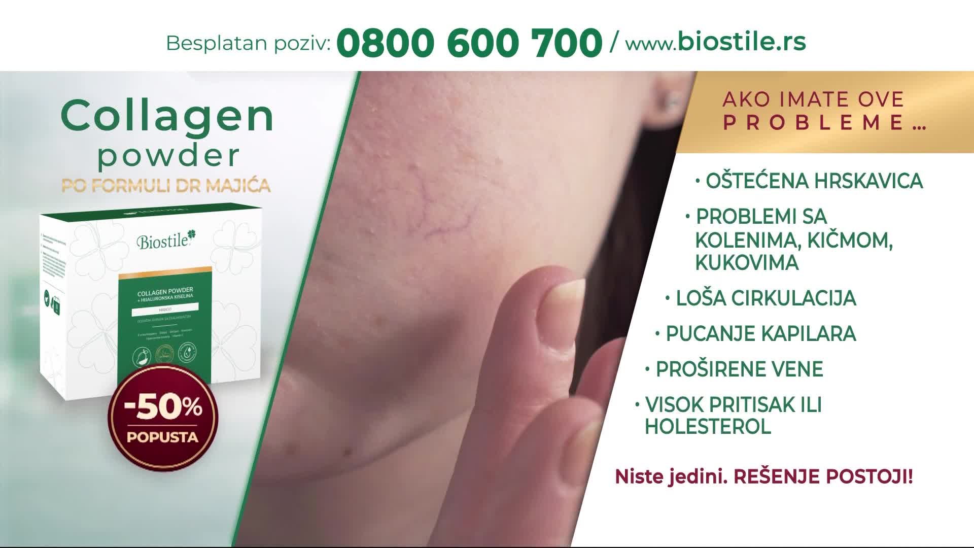 PRVA