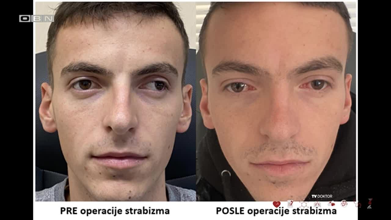 obn