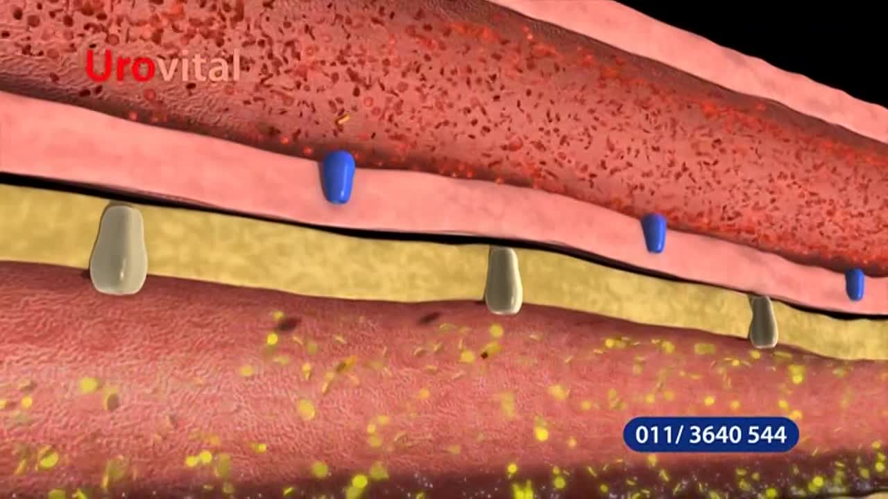 obn